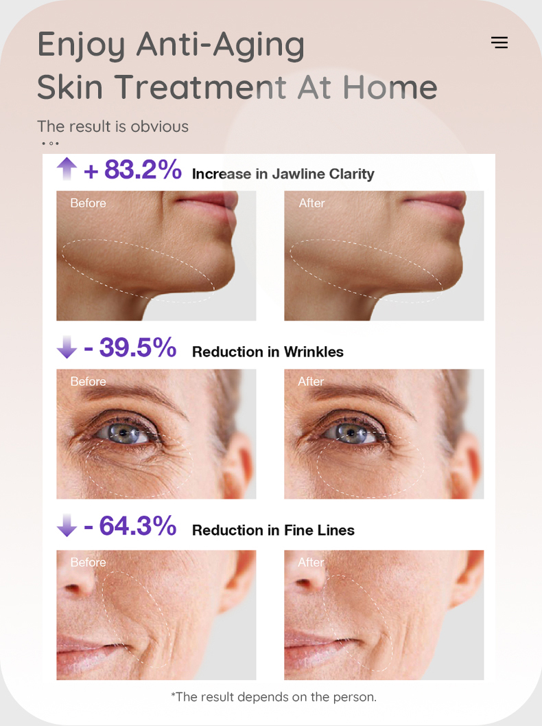 VITALY 3-in-1 Facial Massager Beauty Device-6
